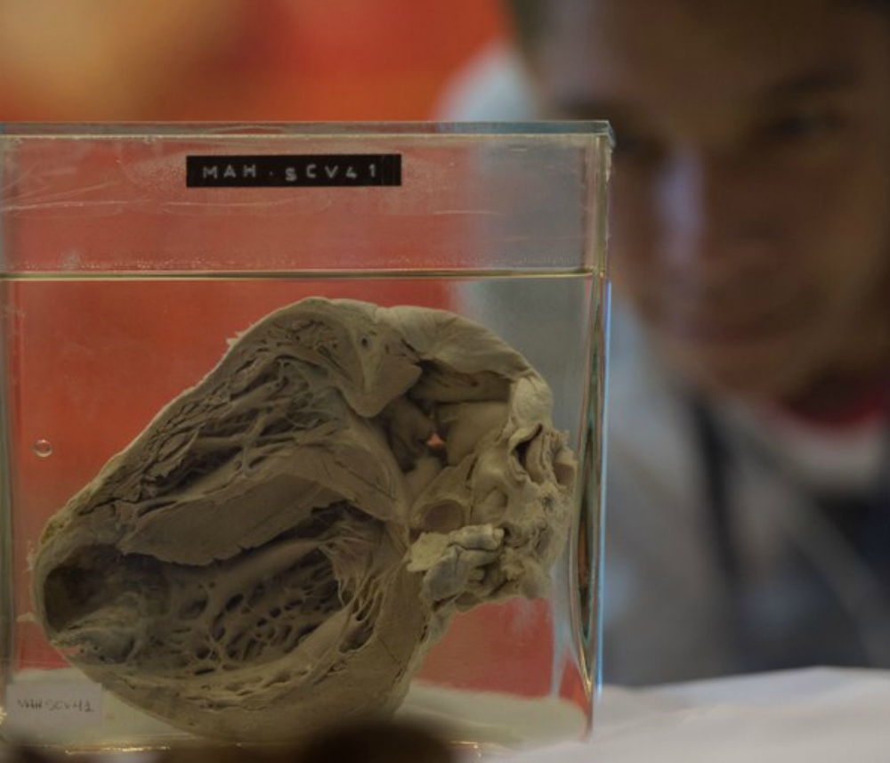 Hipertensão é um dos principais fatores de risco para doenças coronarianas (Marcelo Camargo/ Agência Brasil)